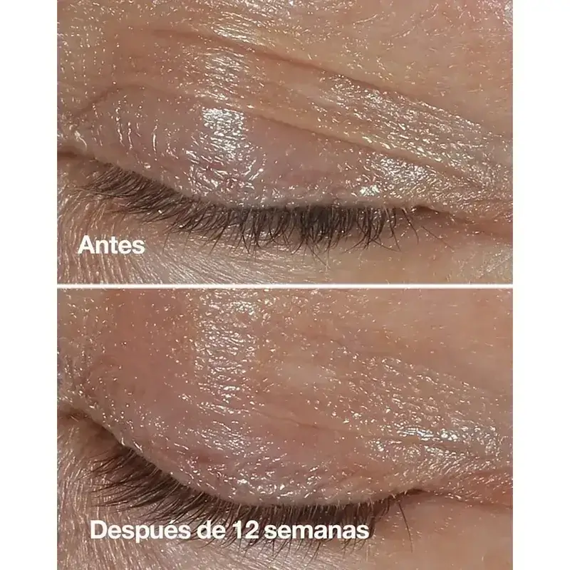 Clinique Smart Clinical Repair Crema de Contorno de Ojos de Corrección Antiarrugas, 3x15 ml - Image 3