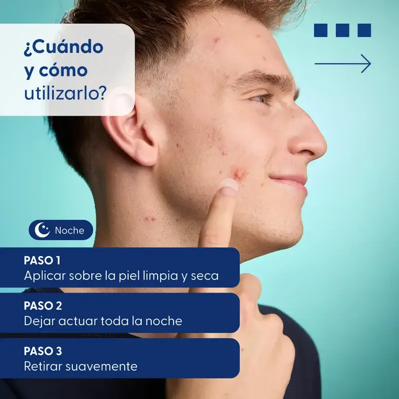 Urgo Spots Parches Hidrocoloides Micro Needling, 9 Unidades - Image 5